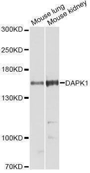 Anti-DAPK1 Antibody
