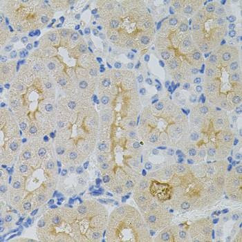 Anti-GNA13 Antibody