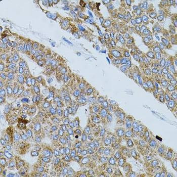Anti-GNA13 Antibody