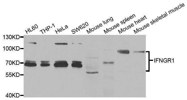 Anti-IFNGR1 Antibody