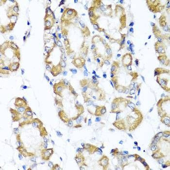 Anti-ST6GAL1 Antibody