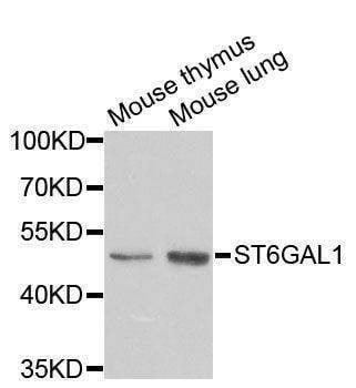 Anti-ST6GAL1 Antibody