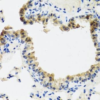 Anti-ST6GAL1 Antibody