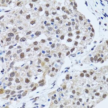 Anti-TP53BP1 Antibody