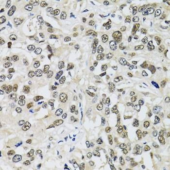 Anti-TP53BP1 Antibody