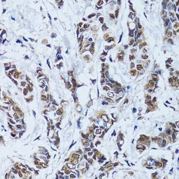 Anti-TP53BP1 Antibody