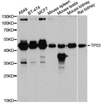 Anti-TP53 Antibody
