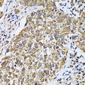 Anti-TP53 Antibody