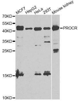 Anti-PROCR Antibody