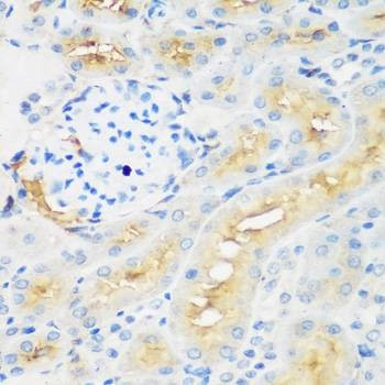 Anti-PROCR Antibody