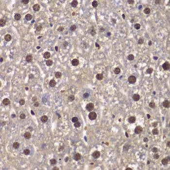 Anti-SMARCB1 Antibody