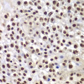 Anti-SMARCB1 Antibody