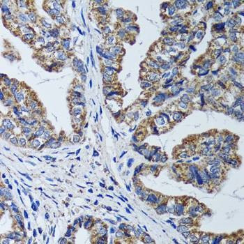 Anti-ATP5B Antibody