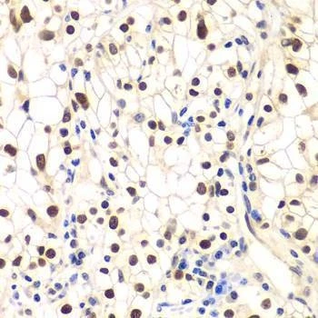 Anti-NFKBIB Antibody