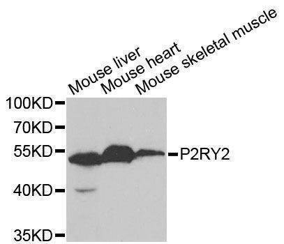 Anti-P2RY2 Antibody