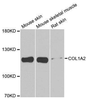 Anti-Mouse/Rat COL1A2 Antibody