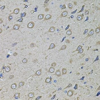Anti-Mouse/Rat COL1A2 Antibody