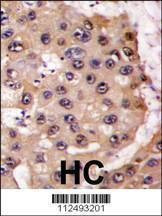 Anti-PSMA5 (Center) Antibody