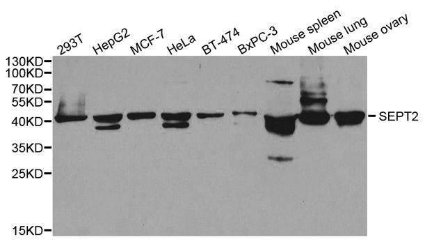 Anti-SEPT2 Antibody