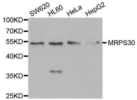 Anti-MRPS30 Antibody