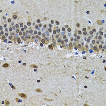 Anti-SPIN1 Antibody