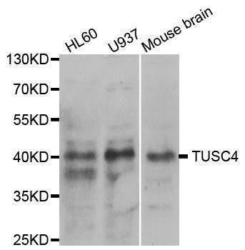 Anti-NPRL2 Antibody