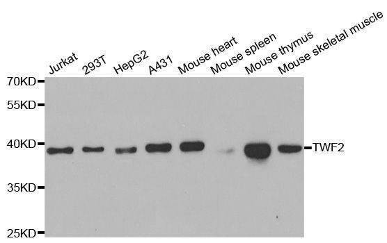 Anti-TWF2 Antibody