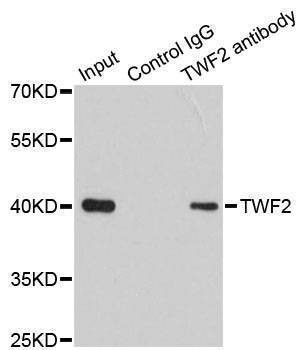 Anti-TWF2 Antibody
