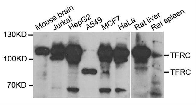 Anti-TFRC Antibody