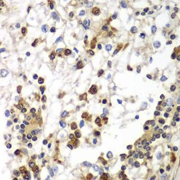 Anti-SND1 Antibody