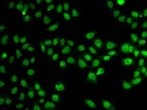 Anti-SND1 Antibody