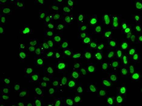 Anti-SF3B2 Antibody