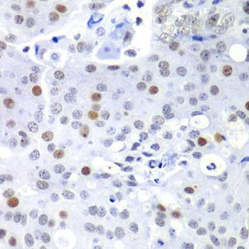 Anti-SF3B2 Antibody