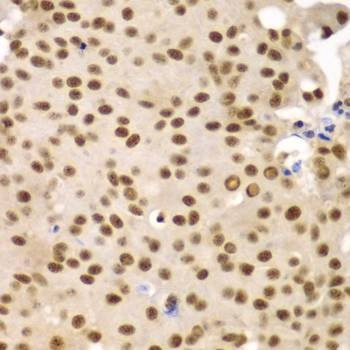 Anti-SF3B2 Antibody