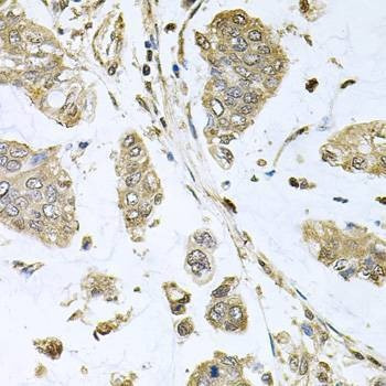 Anti-SBDS Antibody