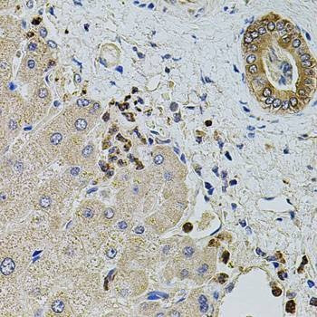 Anti-KTN1 Antibody