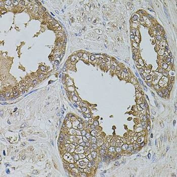 Anti-KTN1 Antibody