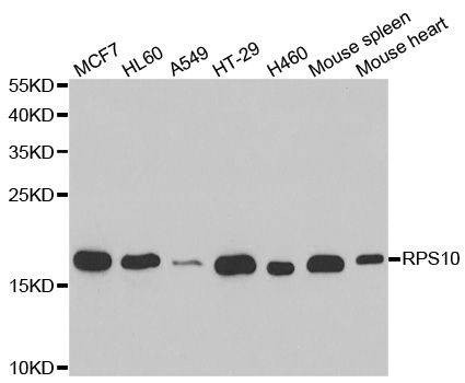 Anti-RPS10 Antibody
