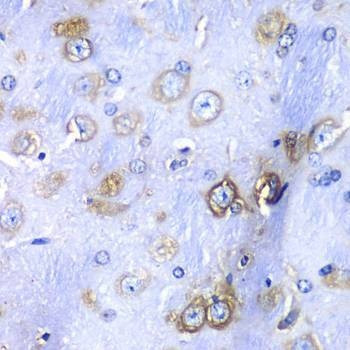 Anti-RPS3A Antibody