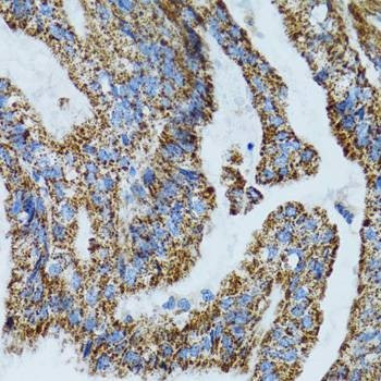Anti-MRPL28 Antibody