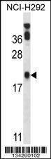 Anti-PERP (C-term) Antibody