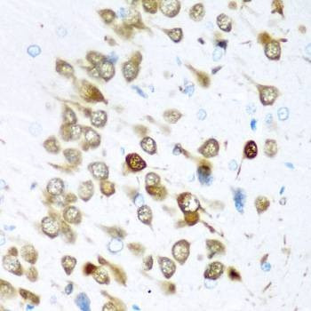 Anti-ELAVL3 Antibody