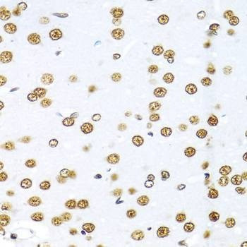 Anti-KHDRBS1 Antibody