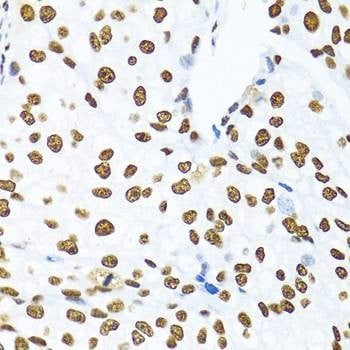 Anti-KHDRBS1 Antibody