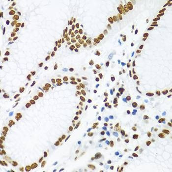 Anti-KHDRBS1 Antibody