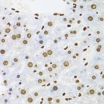 Anti-KHDRBS1 Antibody