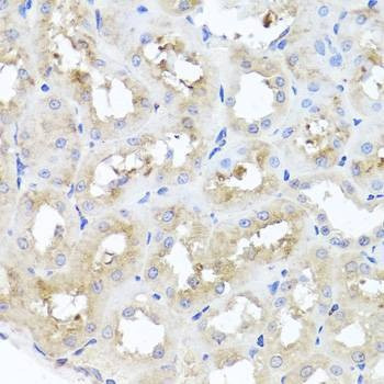 Anti-GSK3B Antibody