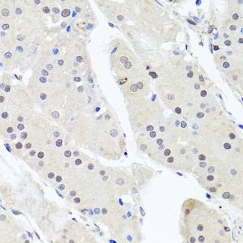 Anti-GSK3B Antibody