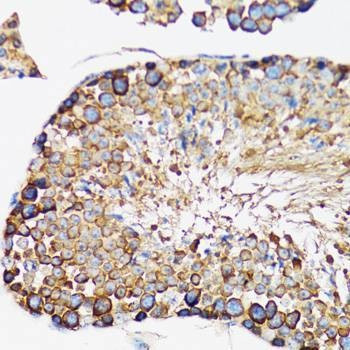 Anti-IRAK4 Antibody