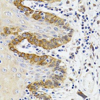 Anti-ESD Antibody